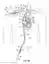 Fig. 20 - TWO-PIECE TRANSSEPTAL CANNULA, DELIVERY SYSTEM, AND METHOD OF DELIVERY