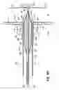 Fig. 25 - TWO-PIECE TRANSSEPTAL CANNULA, DELIVERY SYSTEM, AND METHOD OF DELIVERY