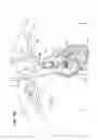 Fig. 35 - TWO-PIECE TRANSSEPTAL CANNULA, DELIVERY SYSTEM, AND METHOD OF DELIVERY