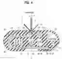 Fig. 04 - MEDICAL INSTRUMENT