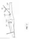 Fig. 06 - Surgical Navigation System Component Fault Interfaces and Related Processes