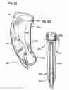 Fig. 30 - Angiographic injector and injection method