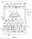 Fig. 12 - SYSTEM AND METHOD FOR DISPLAYING ULTRASOUND MOTION TRACKING INFORMATION