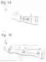 Fig. 02 - SYSTEMS, DEVICES, AND METHODS FOR TREATING RESTLESS LEG SYNDROME AND PERIODIC LIMB MOVEMENT DISORDER
