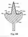 Fig. 08 - Method and apparatus for simultaneously collecting exocervical and endocervical samples