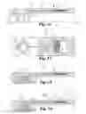 Fig. 05 - Devices and methods for expression of bodily fluids from an incision