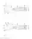 Fig. 04 - Device and method for determining force of a knee joint