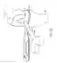 Fig. 35 - Device and method for determining force of a knee joint