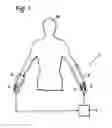 Fig. 02 - Motion assist apparatus
