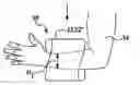 Fig. 01 - Shape memory polymer medical cast