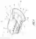 Fig. 02 - Wrist support