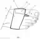 Fig. 02 - Orthotic device and method of use