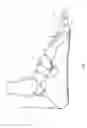 Fig. 03 - Orthotic device and method of use