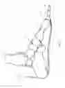 Fig. 04 - Orthotic device and method of use