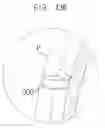 Fig. 22 - TROCAR FOR A SINGLE PORT SURGERY