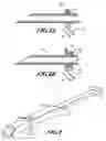 Fig. 06 - STRAIGHT CUTTING TIP FOR A FULL LARGE BORE SUBCUTANEOUS IMPLANTATION INSTRUMENT