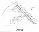 Fig. 10 - STRAIGHT CUTTING TIP FOR A FULL LARGE BORE SUBCUTANEOUS IMPLANTATION INSTRUMENT