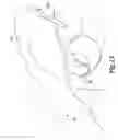 Fig. 22 - SURGICAL INSTRUMENTS FOR IN VIVO ASSEMBLY