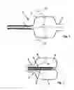 Fig. 02 - Device to be used in healing processes