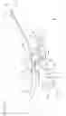 Fig. 02 - Systems and methods for providing a conventional integrated catheter with universal grip