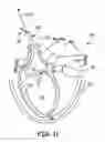 Fig. 07 - Methods and systems for accessing the pericardial space