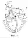 Fig. 08 - Methods and systems for accessing the pericardial space