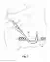 Fig. 08 - Enema device