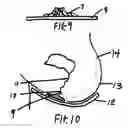Fig. 07 - Sanitary enhanced absorption wick device