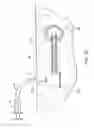 Fig. 06 - Transdermal venous access locking solution