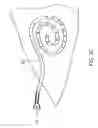 Fig. 09 - Transdermal venous access locking solution
