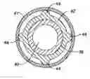 Fig. 01 - Guide catheter with removable support