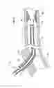 Fig. 06 - Guide catheter with removable support
