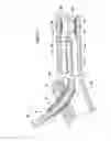 Fig. 10 - Guide catheter with removable support