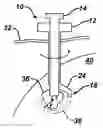 Fig. 01 - Methods and devices for preparing and implanting tissue scaffolds