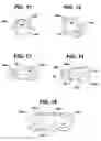 Fig. 06 - Methods and devices for preparing and implanting tissue scaffolds
