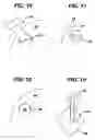 Fig. 07 - Methods and devices for preparing and implanting tissue scaffolds