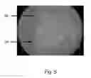 Fig. 06 - Patterned laser treatment