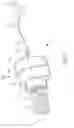 Fig. 02 - TRACHEOBRONCHIAL PULMONARY CRYOGENIC THERAPEUTIC METHOD AND APPARATUS