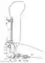 Fig. 01 - Self-centring elbow fixation device without guide wire