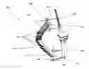 Fig. 01 - External fixation devices and methods of use