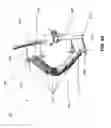 Fig. 07 - External fixation devices and methods of use