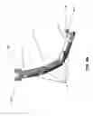 Fig. 08 - External fixation devices and methods of use