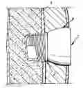Fig. 01 - Implant abutment
