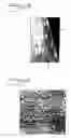 Fig. 03 - Implant abutment