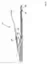 Fig. 44 - Insertion instrument for artificial discs