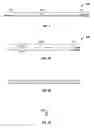 Fig. 02 - System and method for removing an implanted catheter from a patient