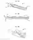 Fig. 19 - Clip applier with migrational resistance features