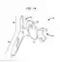 Fig. 22 - Clip applier with migrational resistance features