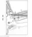 Fig. 35 - Clip applier with migrational resistance features