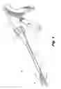 Fig. 02 - Crimp and release of suture holding buttress material